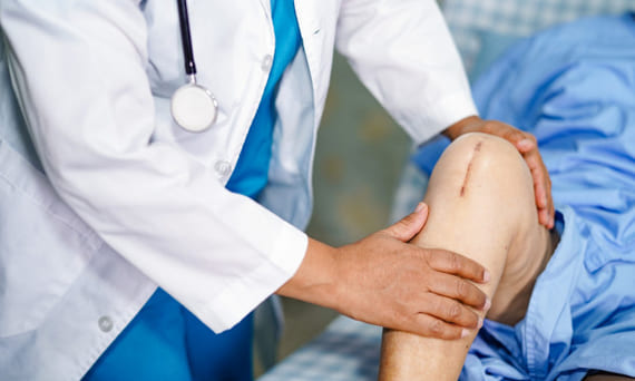 Total Knee Replacement: Common Questions Answered